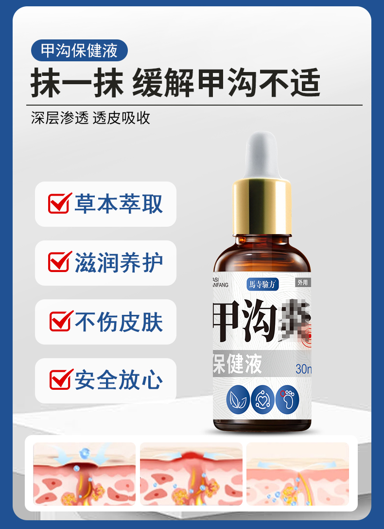 抹一抹，緩解甲溝不適